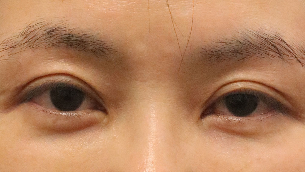 医師の診察を受ける時期