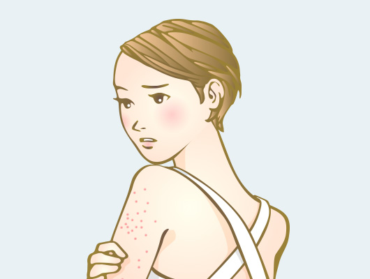 ヘルペス・帯状疱疹の原因