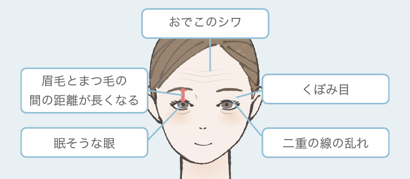 おでこのシワ・くぼみ目など