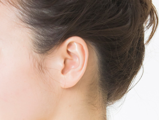耳の形成の特徴