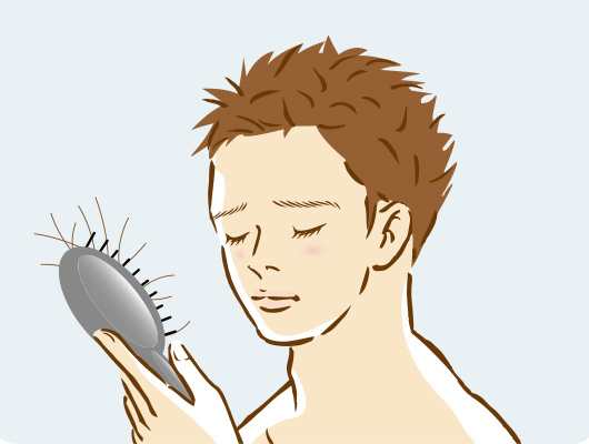 AGA（男性型脱毛症）の原因