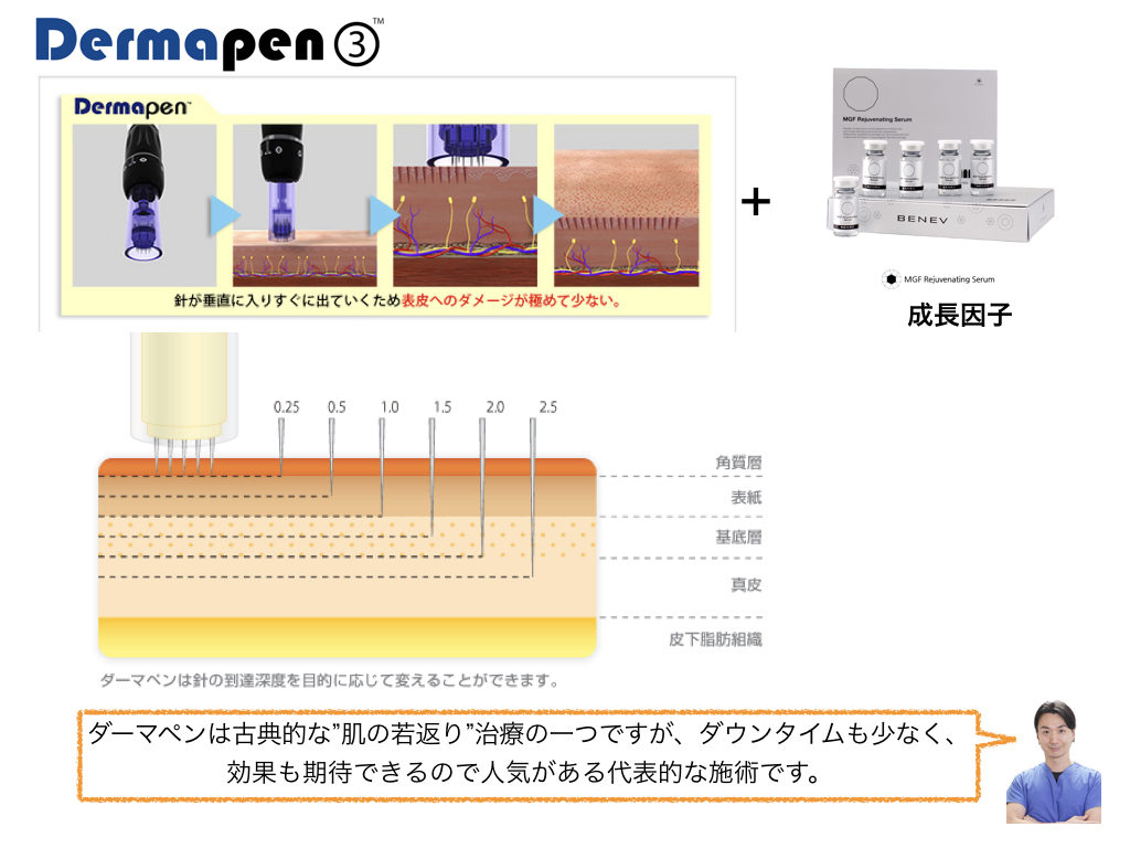 ダーマペン＋クマ治療  横浜市鶴見の形成・美容外科 エムズクリニック