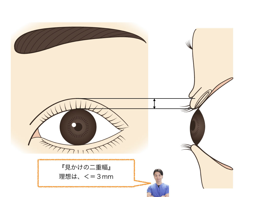 二重幅の調整 横浜市鶴見の形成 美容外科 エムズクリニック