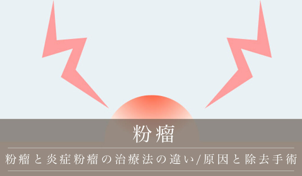 粉瘤と炎症粉瘤の治療法の違い/できる原因・おでこと背中のアテローム除去手術