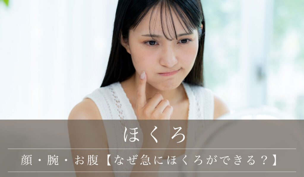 顔・腕・お腹【なぜ急にほくろができる？】急に増えたり盛り上がるほくろについても解説
