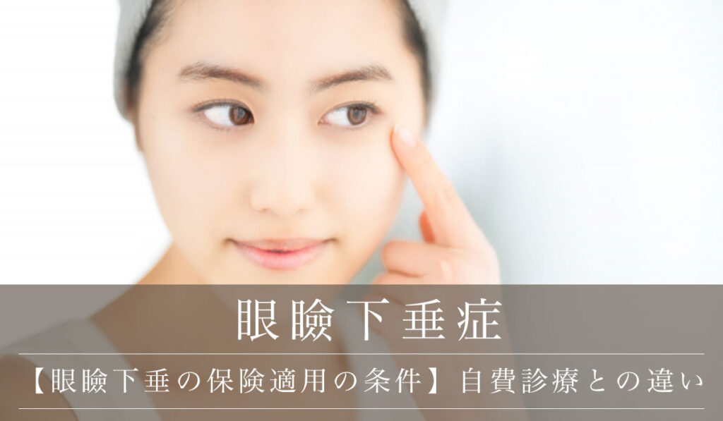 【眼瞼下垂の保険適用の条件】自費診療との違い/美容外科によりデザインも配慮