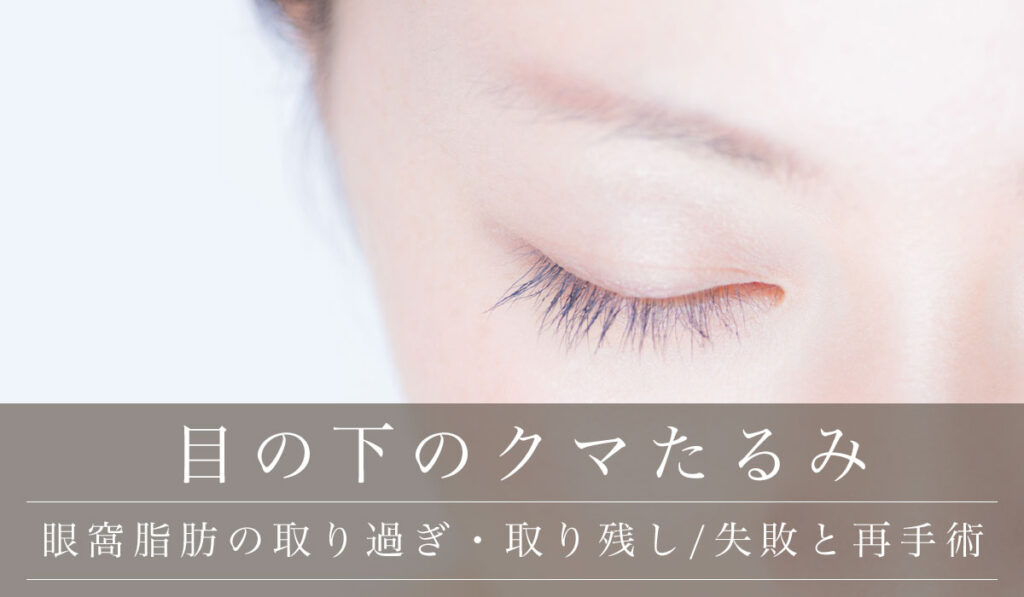 眼窩脂肪の取り残し・脱脂による脂肪取りは変わらない/意味ない？失敗画像と目の下のクマ取り再手術