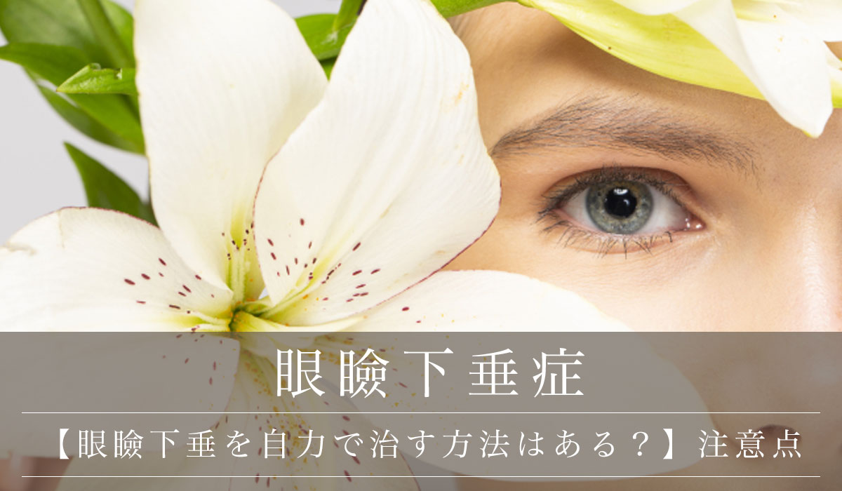 【眼瞼下垂を自力で治す方法はある？】注意点