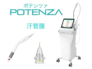 汗管腫にはポテンツァ!痛みやダウンタイムも最小限でキレイに♪
