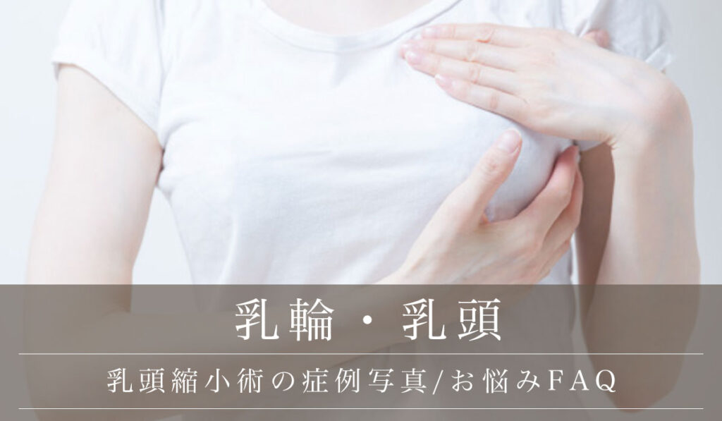 乳頭縮小術の症例写真・術後の経過/リスク・名医の選び方などお悩みFAQ