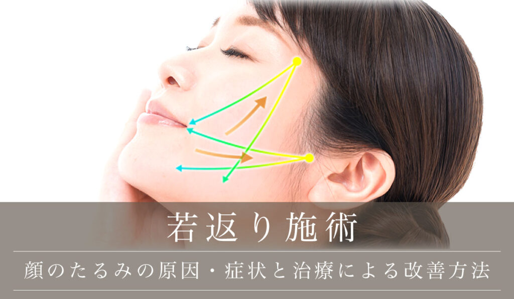 顔のたるみを解消して若返り/たるみの原因・症状と治療による改善方法