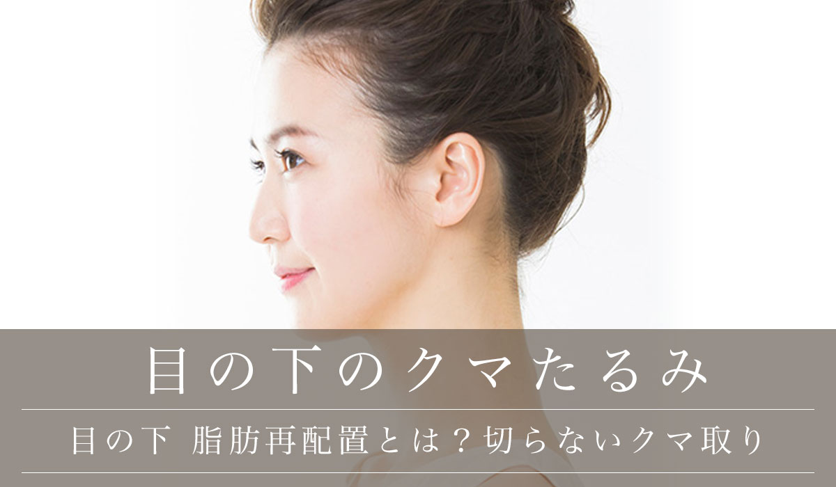 目の下【脂肪再配置とは？】皮膚を切らないクマ取りのやり方・裏ハムラ法で涙袋が復活した事例
