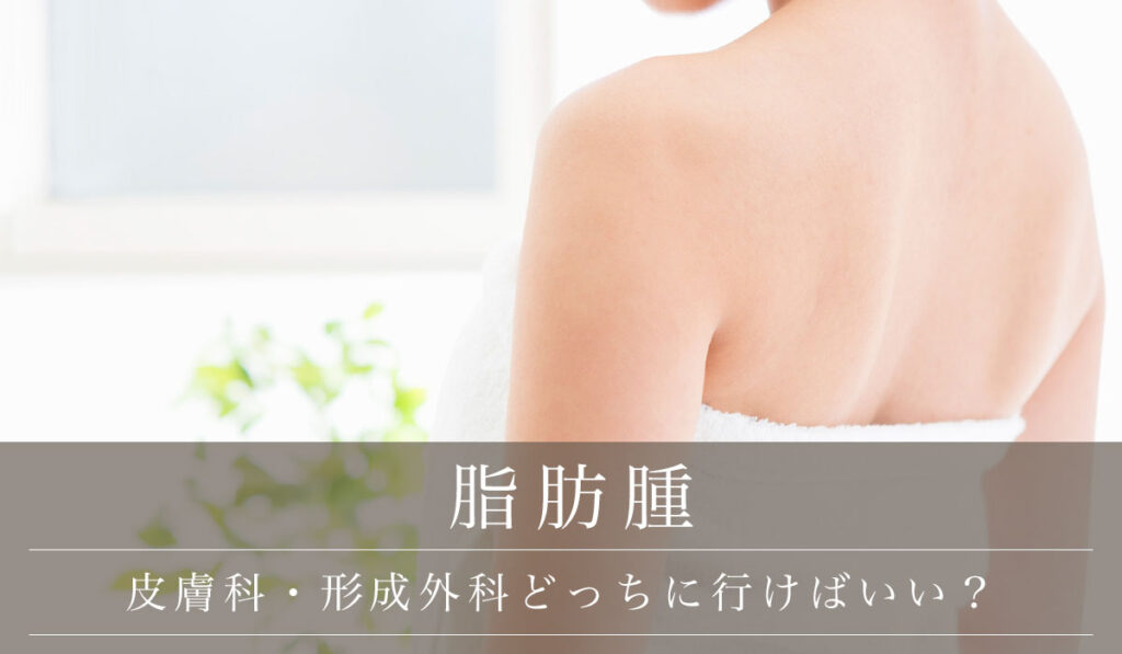脂肪腫【皮膚科・形成外科どっちに行けばいい？】特徴と治療の違い