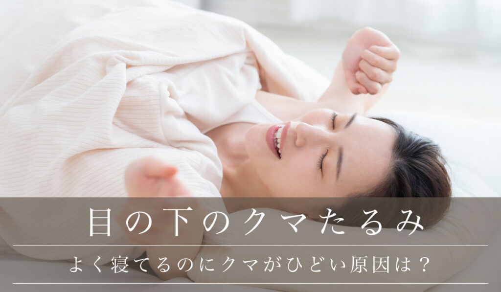 【よく寝てるのにクマがひどい原因は？】睡眠不足のクマを消す方法・治し方