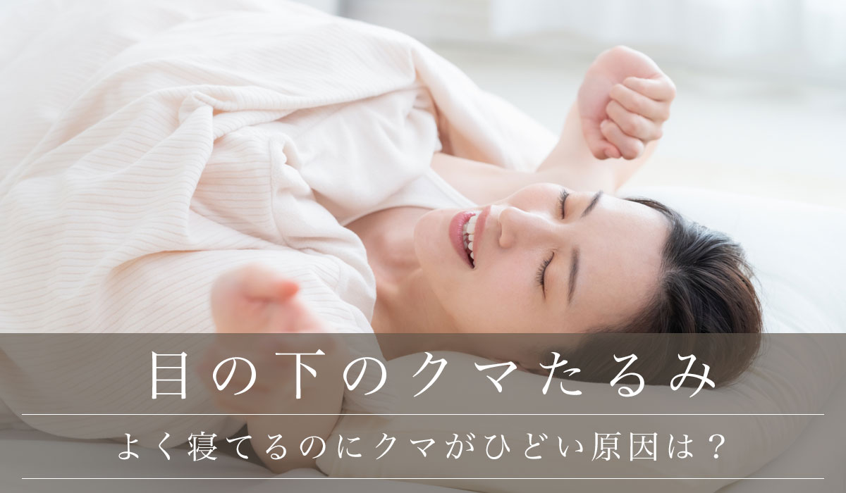 よく寝てるのにクマがひどい原因は?