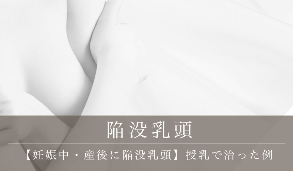 【妊娠中・産後に陥没乳頭（乳首の凹み）になった】授乳で治った例はある？産前産後のケア