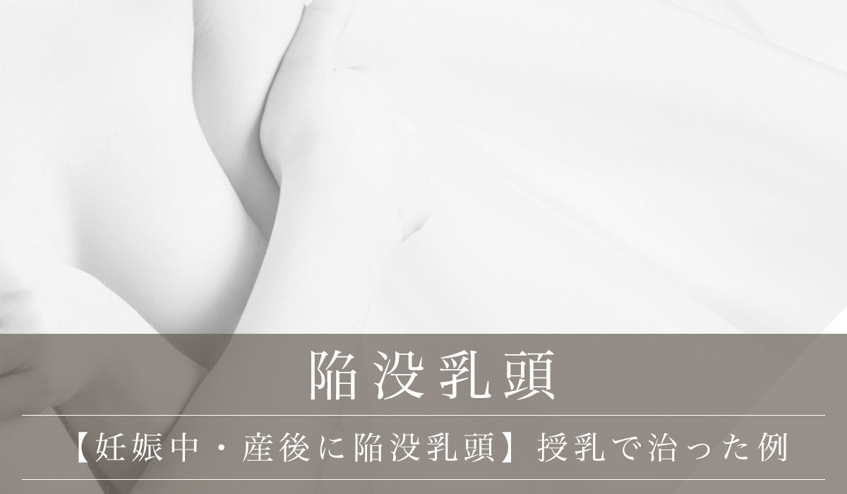 【妊娠中・産後に陥没乳頭】授乳で治った例