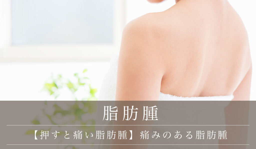 【押すと痛い脂肪腫】痛みのある脂肪腫と似ている疾患の検査・手術法