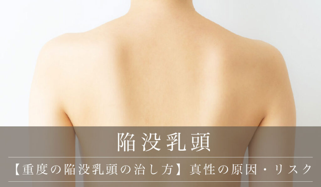 【重度の陥没乳頭の治し方・手術治療】真性の症状・原因・リスクと授乳困難な場合の保険適用
