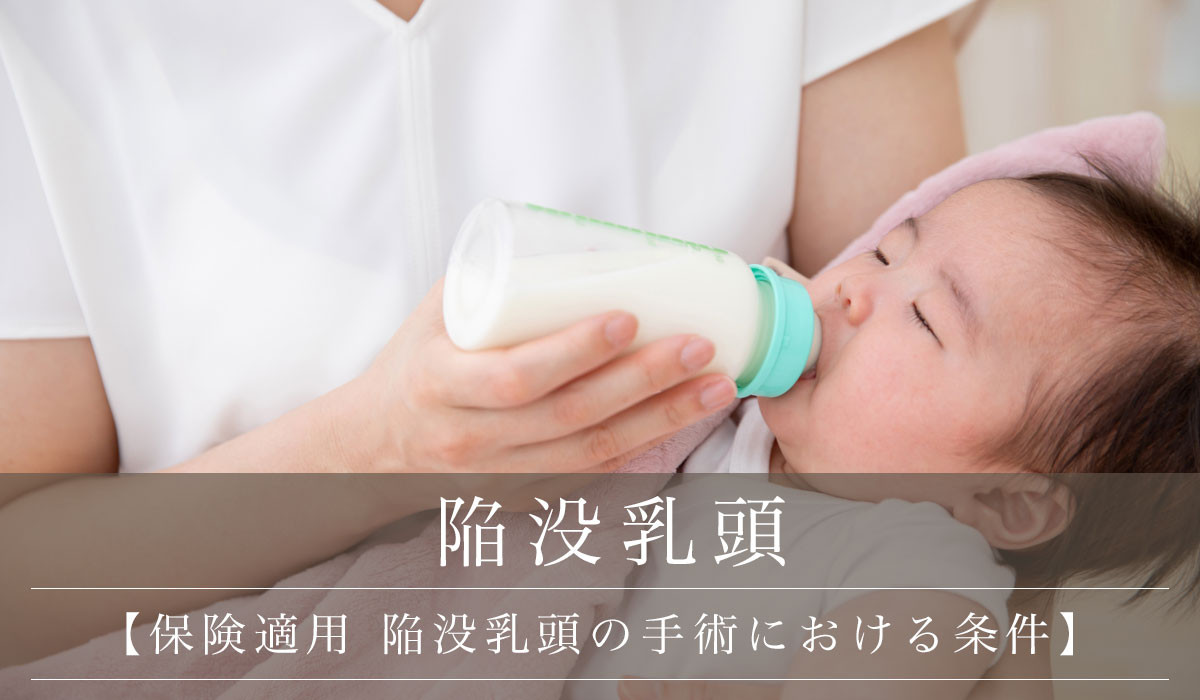 【保険適用 陥没乳頭の手術における条件】