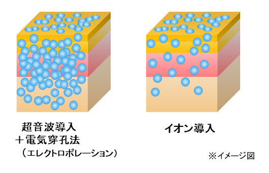 イオン導入との比較イメージ