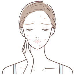 ニキビに悩む女性イラスト