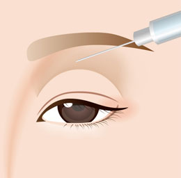 目の上にヒアルロン酸のイラスト