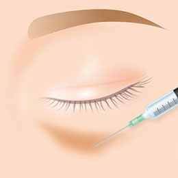 脂肪注入のイラスト