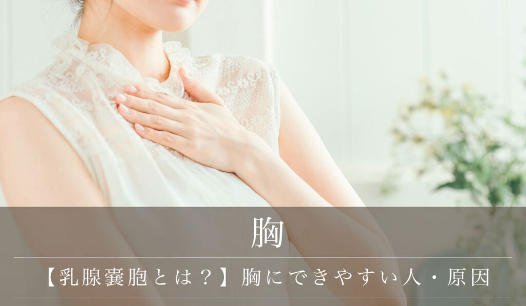 【乳腺嚢胞（のうほう）とは？】胸にできやすい人・主な原因と症状
