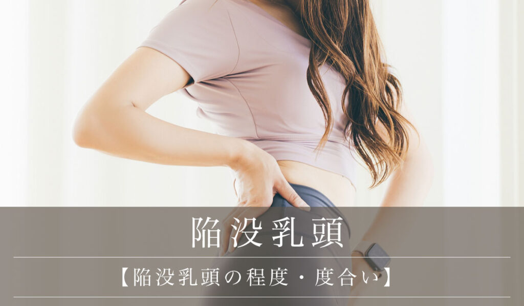 【陥没乳頭の程度・度合い】後天性の原因や中等度の治療についても解説