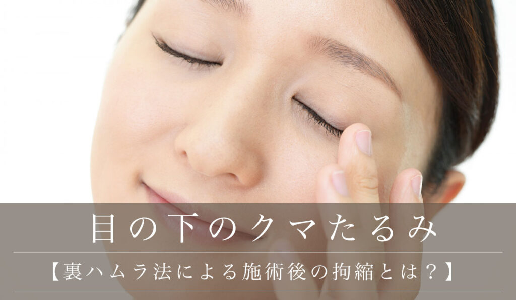 【裏ハムラ法による施術後の拘縮とは？】いつからいつまで続くのか、マッサージなど禁止事項も解説