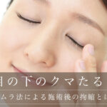【裏ハムラ法による施術後の拘縮とは？】