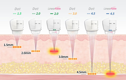 ハイフの効果イメージ