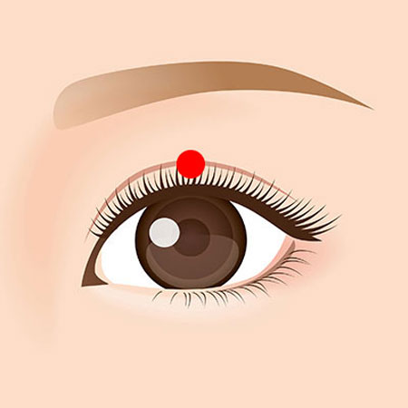 二重埋没法のイラスト