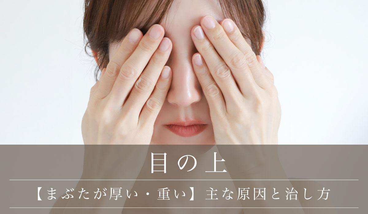 【まぶたが厚い・重い】主な原因と治し方