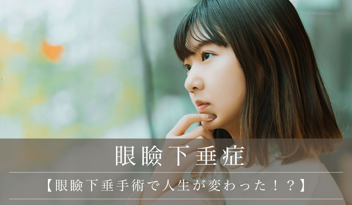 眼瞼下垂手術で人生が変わった！？