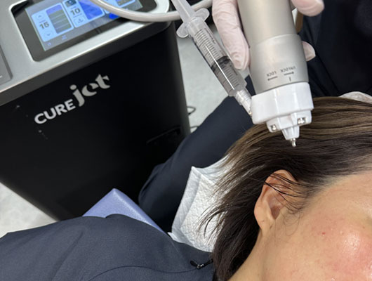 女性にキュアジェット施術をしている様子