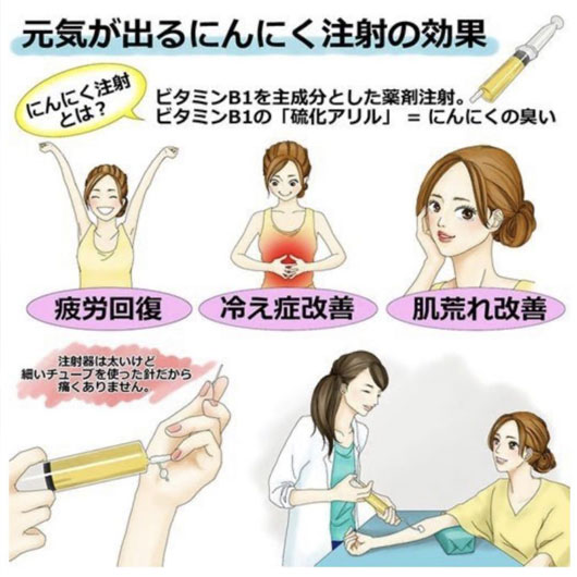 元気が出るにんにく注射の効果解説