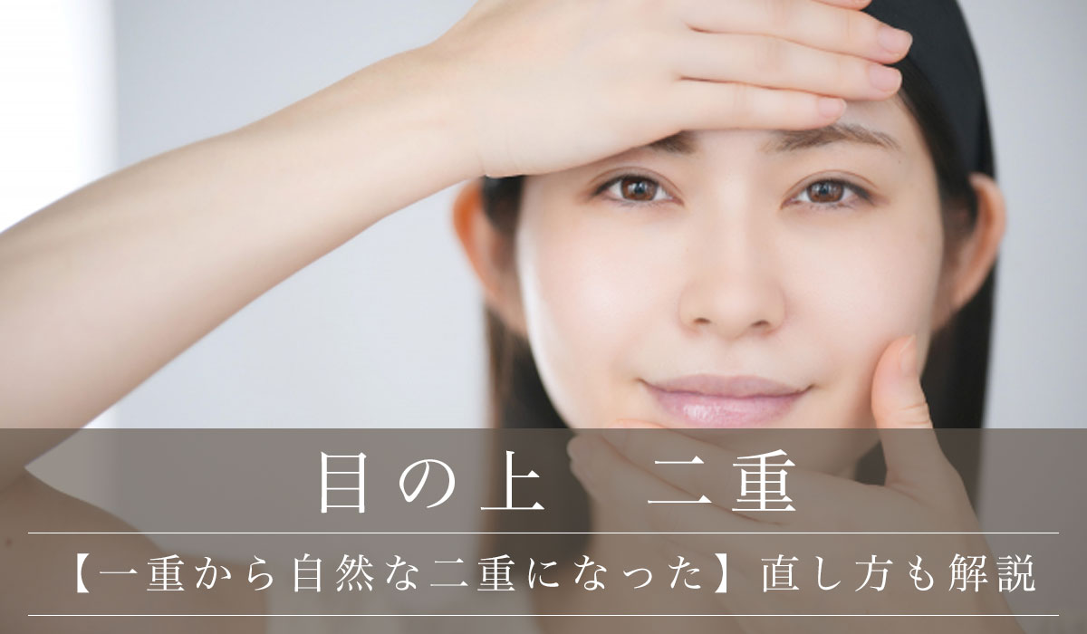 【一重から自然な二重になった】直し方も解説
