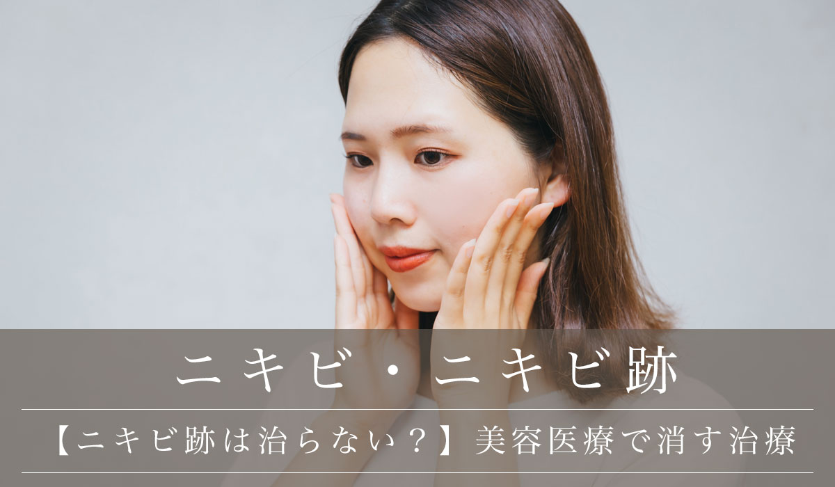 【ニキビ跡は治らない?】美容医療で消す治療