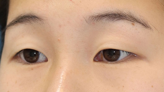 一重女性のイメージ