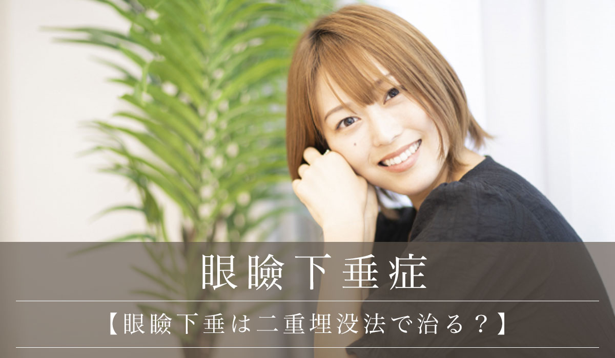 【眼瞼下垂は二重埋没法で治る？】