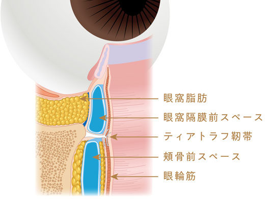 通常の眼窩脂肪とティアトラフ靭帯の構造