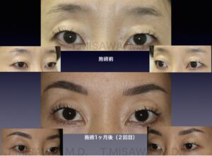 眉ってあるとないとでは大違い。毎日の手間，省けるかも？