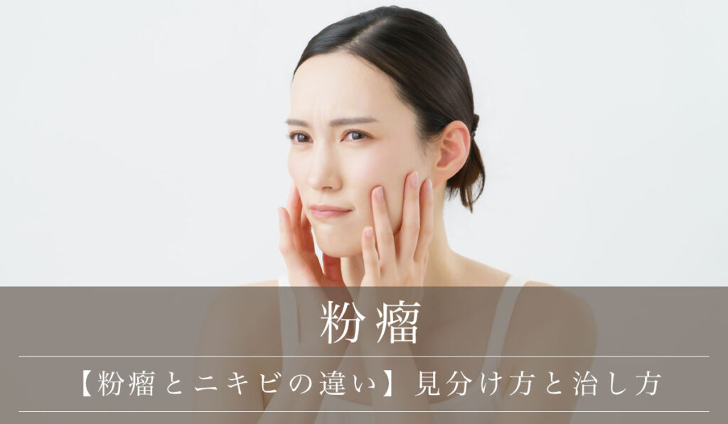 【粉瘤とニキビの違い】見分け方とそれぞれの治し方について解説