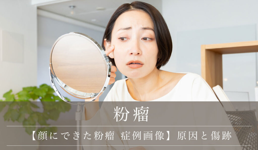【顔にできた粉瘤 症例画像】顔にできる原因と傷跡について