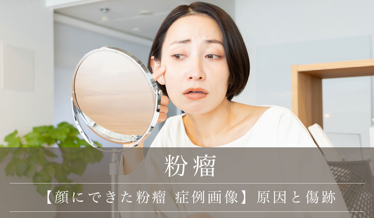 【顔にできた粉瘤 症例画像】原因と傷跡