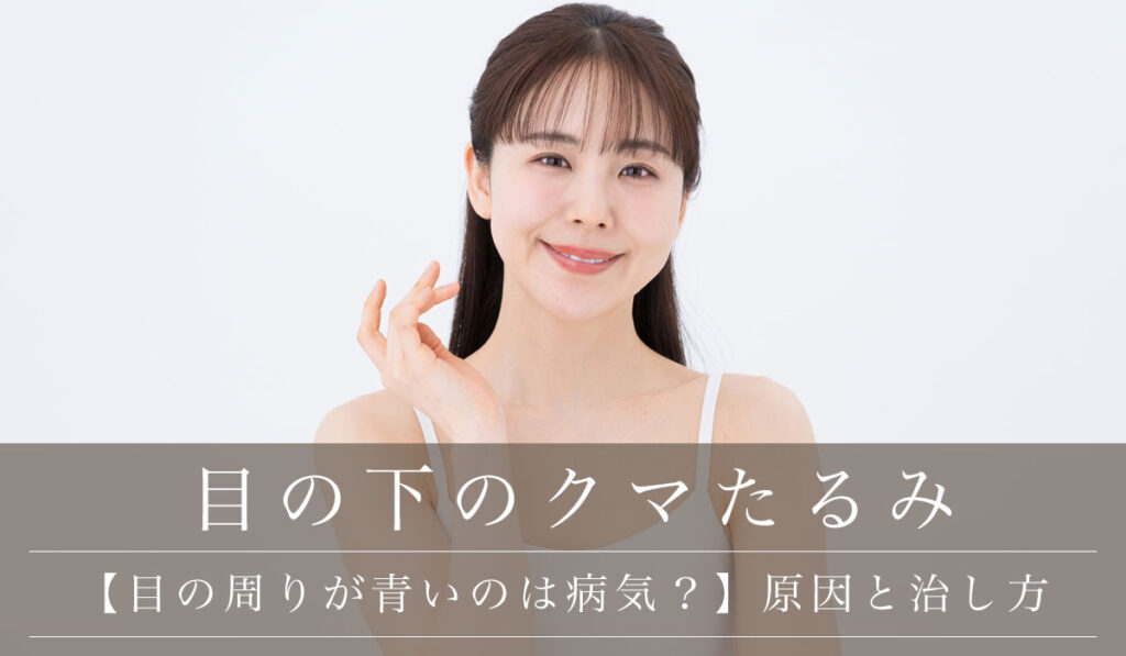 【目の周りが青いのは病気？】青クマの原因と改善治療・治し方