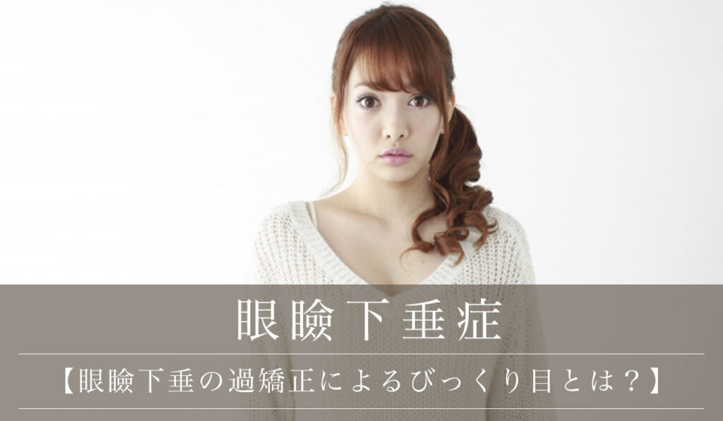【眼瞼下垂の過矯正によるびっくり目とは？】手術後に起こる原因・主な症状・治す方法