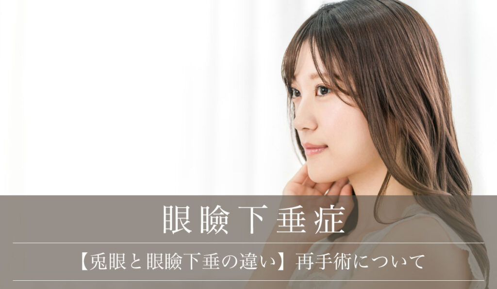 【兎眼と眼瞼下垂の違い】手術後の合併症と兎眼になった場合の再手術